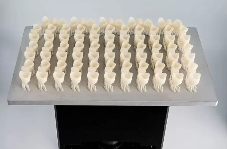 تاج مؤقت وجسر